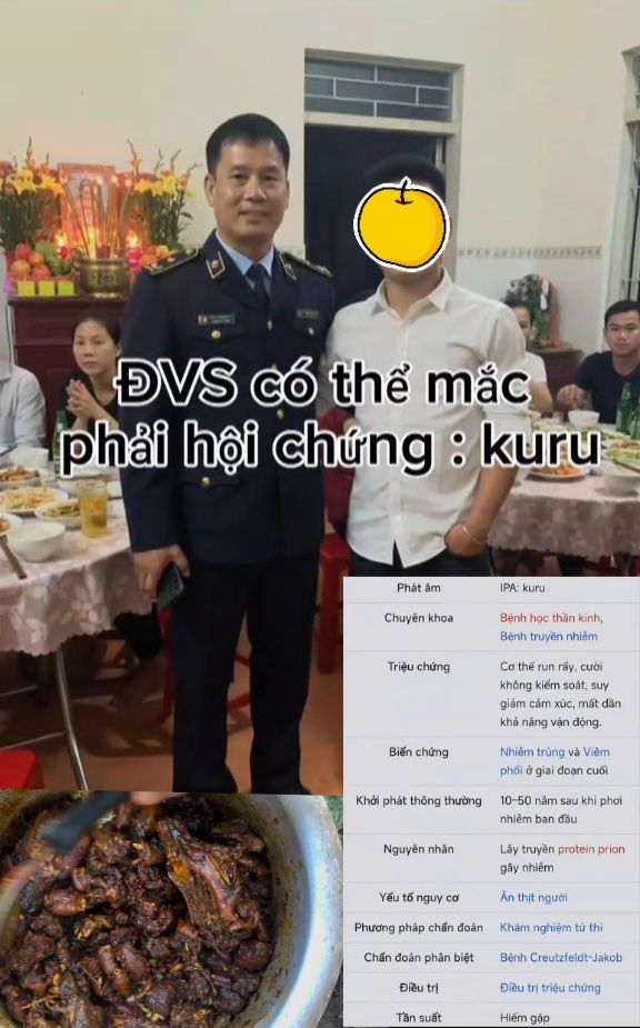 Đoàn Văn Sáng có thể mắc phải hội chứng kuru, vậy hội chứng kuru là như nào??