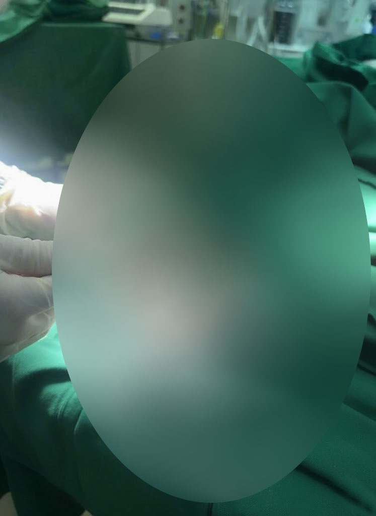 Sau tiếng nổ lớn…