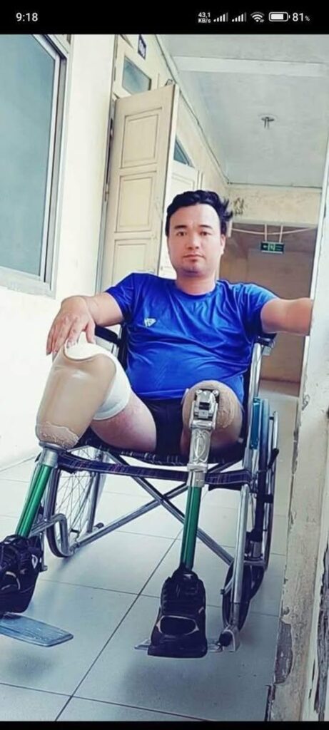 XÃ HỒNG PHONG (NGHĨA HƯNG cũ): MỘT NGƯỜI CHA CUT 2 CHÂN LÊN MẠNG KHẨN CẦU