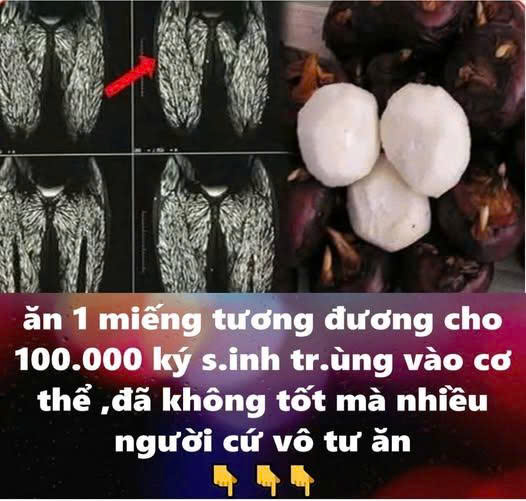 Ăn một miếng tương đương cho 100.000 con ký sinh trùng vào bụng – Blog