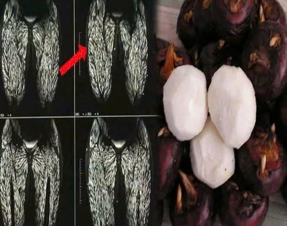 Ăn một miếng tương đương cho 100.000 con ký sinh trùng vào bụng